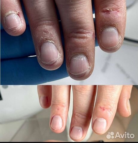 Гигиеническая обработка