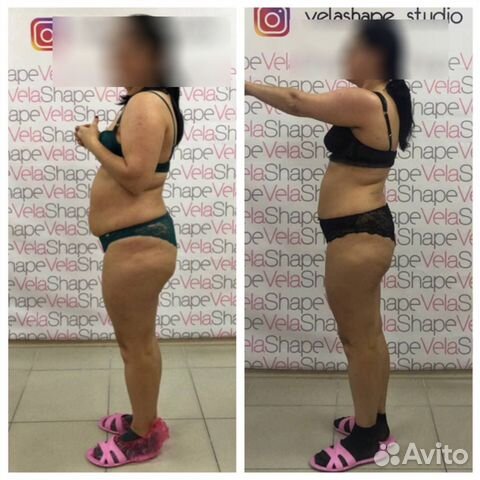 Антицеллюлитный массаж Коррекция фигуры. Похудение